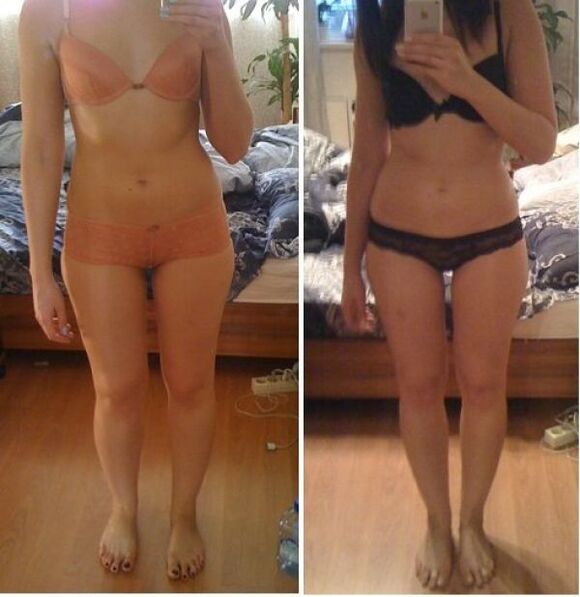 La niña antes y después de adelgazar con la dieta japonesa en 14 días