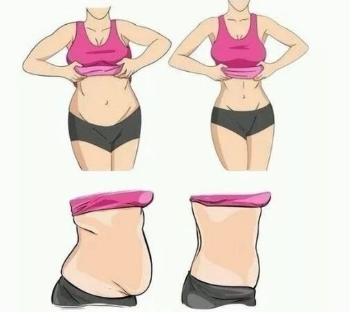 Pérdida abdominal